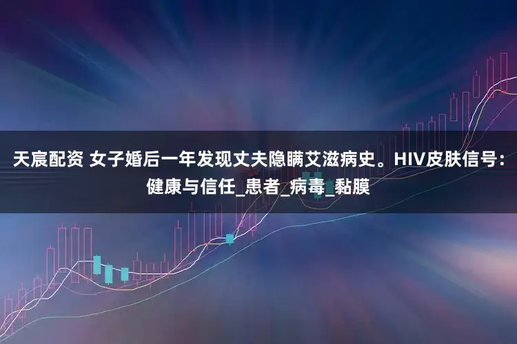 天宸配资 女子婚后一年发现丈夫隐瞒艾滋病史。HIV皮肤信号：健康与信任_患者_病毒_黏膜